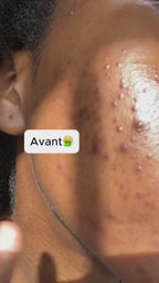 Booster d’éclat - Huile de noyau d'abricot pure
